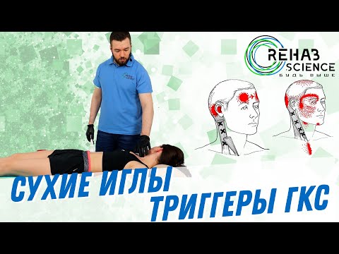 Видео: Метод сухие иглы на ГКС.