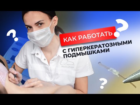 Видео: Электроэпиляция на подмышках