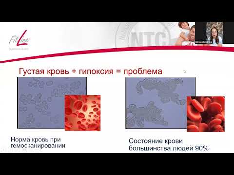 Видео: Здоровье сердца и сосудов - врачи Мария Луговских, Евгения Кичигина 13.08.25