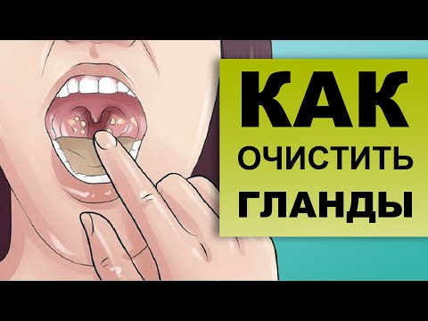 Видео: КАК ПРОМЫВАТЬ ГЛАНДЫ