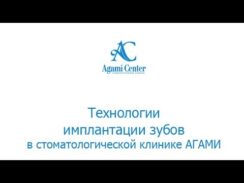 Видео: Качественная имплантация в клинике АГАМИ