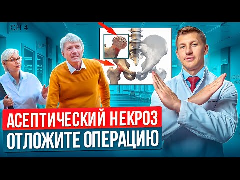 Видео: Асептический некроз головки бедренной кости -как диагностировать, как лечить консервативным способом