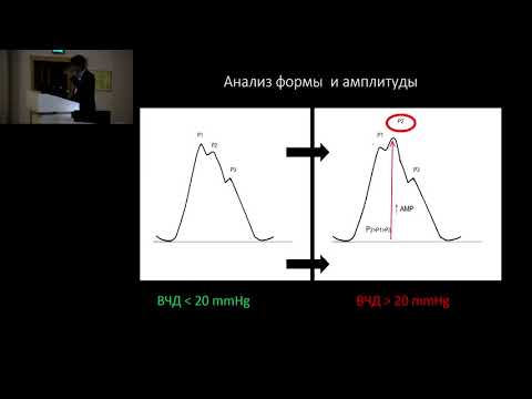 Видео: Волновые характеристики ВЧД Ошоров А.В.
