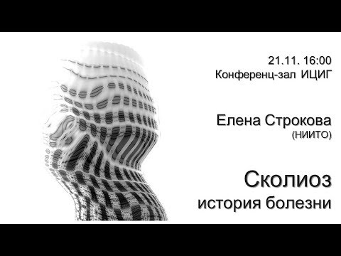 Видео: Елена Строкова «Сколиоз: история болезни»