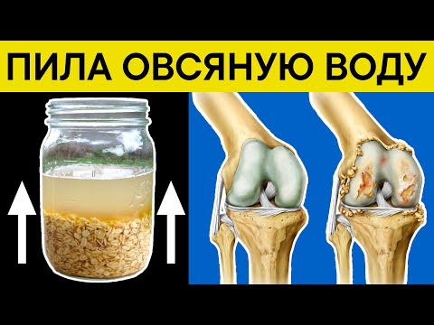 Видео: Пила ОВСЯНУЮ ВОДУ, избавилась от 7 НЕДУГОВ и РЕАЛЬНО ПОХУДЕЛА