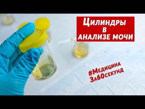 Видео: Цилиндры в моче | Что это такое | Почему появляются цилиндры в моче | Причины появления цилиндров