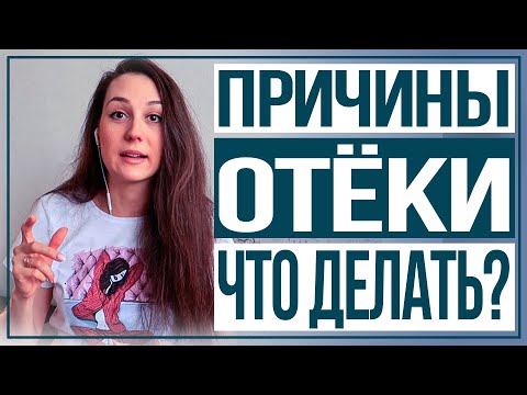 Видео: Отечность. Причины отеков. Как избавиться от отеков ? Отеки и похудение.