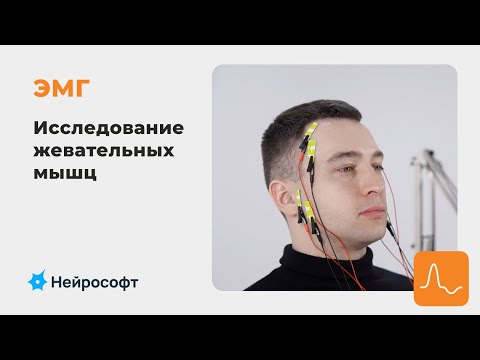Видео: ЭМГ: Возможности применения электромиографии в стоматологической практике