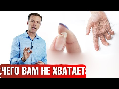 Видео: Почему выпадают волосы, ломаются ногти и сухая кожа? | Каких витаминов не хватает?📣