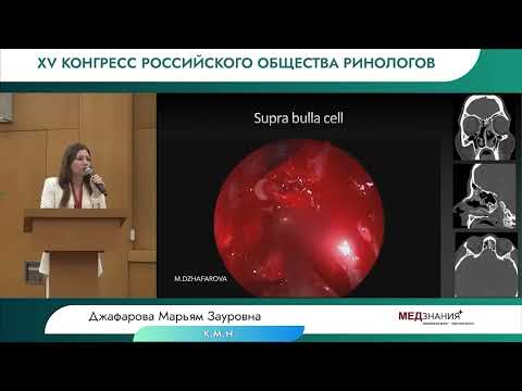 Видео: 30.06.23 FESS ОТ ПРОСТОГО К СЛОЖНОМУ, ОТ РАДИКАЛЬНОСТИ К ФУНКЦИОНАЛЬНОСТИ