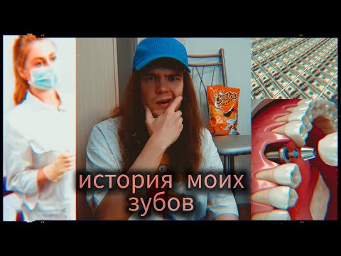 Видео: Моя история зубов (импланты, удаление, развод стоматологов (не всех) )