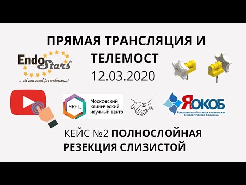 Видео: Полнослойная резекция, телемост МКНЦ-ЯОКОБ 12.03. Клинический случай №2.