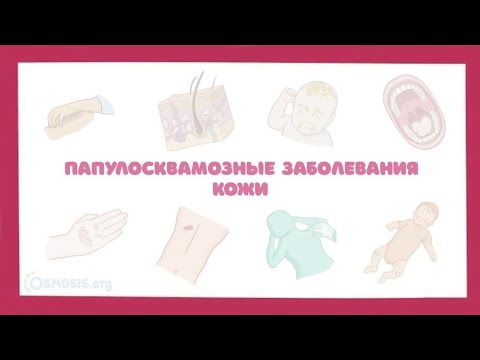 Видео: Атопический дерматит, крапивница, псориаз, лишай, себорея - симптомы, лечение (дерматология)