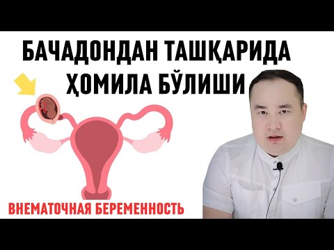Видео: БАЧАДОНДАН ТАШҚАРИ ҲОМИЛА БЎЛИШИ, САБАБИ, БЕЛГИСИ, АСОРАТИ, ОЛДИНИ ОЛИШ ҲАҚИДА ИСЧАНОВ