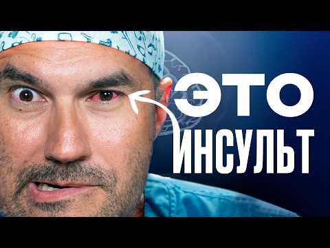 Видео: 5 ранних признаков инсульта — НЕ упусти их!