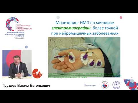 Видео: Нейромышечный блок Груздев В.Е.