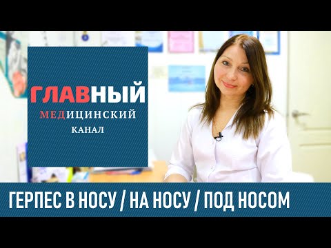 Видео: Как лечить герпес в носу и под носом. Как быстро вылечить герпес на носу