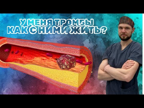 Видео: У МЕНЯ ТРОМБ: КАК ЖИТЬ ДАЛЬШЕ?