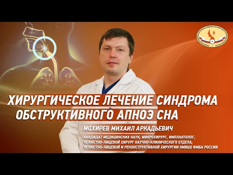 Видео: Хирургическое лечение синдрома обструктивного апноэ сна, показания к лечению СОАС и результаты