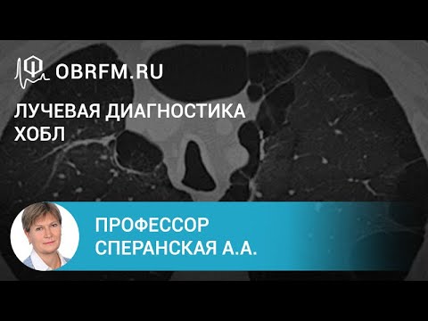 Видео: Профессор Сперанская А.А.: Лучевая диагностика ХОБЛ