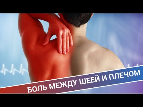 Видео: БОЛЬ МЕЖДУ ШЕЕЙ И ПЛЕЧОМ