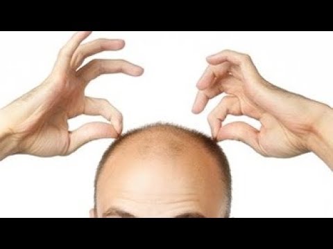 Видео: 100% РЕЗУЛЬТАТ! СОВЕТСКИЙ РЕЦЕПТ для роста и укрепления волос.