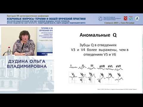 Видео: Зубец Q – повторное знакомство