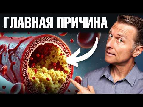 Видео: Лучшая пища для очищения сосудов!✅