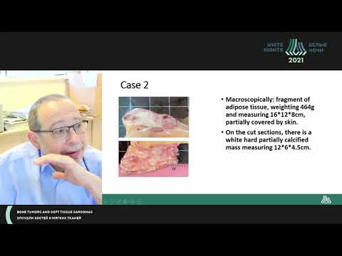 Видео: Необычные случаи опухолей мягких тканей (Ignat Schwartz)
