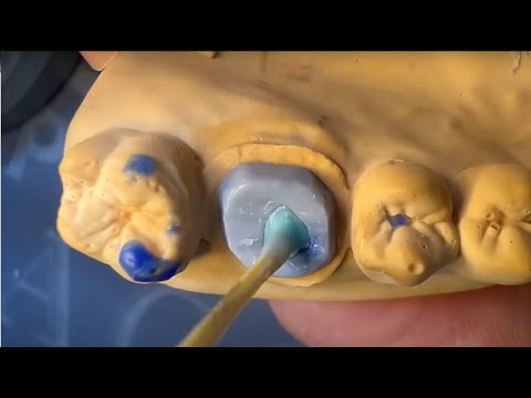 Видео: Разборная вкладка: Моляр