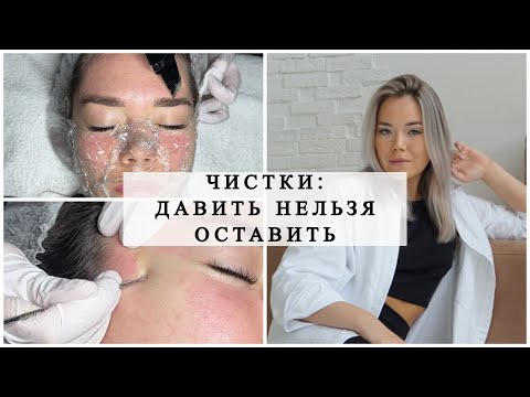 Видео: ЧИСТКИ: ДАВИТЬ НЕЛЬЗЯ ОСТАВИТЬ! СТАВИМ ЗАПЯТУЮ ПРАВИЛЬНО☝️ Как избавиться от прыщей? #акне #прыщи