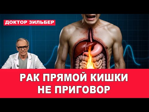 Видео: Рак прямой кишки - не приговор!