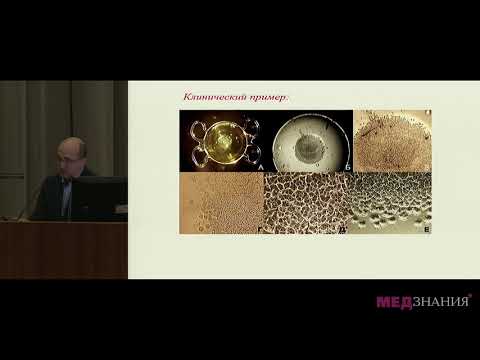 Видео: 8) А.А.Гамидов