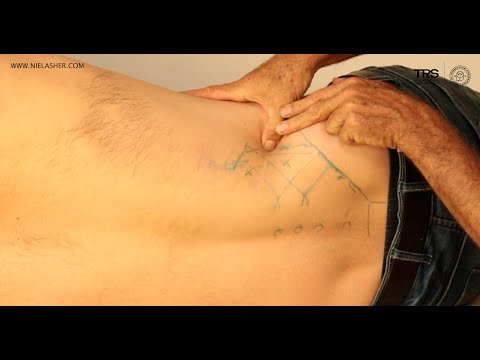 Видео: Воздействие на триггерные точки при боли в спине: квадратная мышца поясницы (QL)