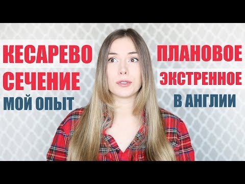 Видео: КЕСАРЕВО ЭКСТРЕННОЕ И ПЛАНОВОЕ в ВЕЛИКОБРИТАНИИ АНГЛИИ