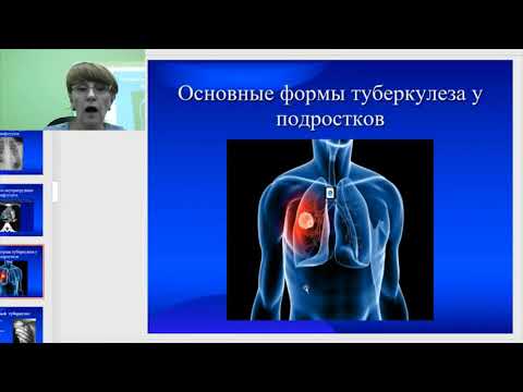 Видео: Туберкулеза у детей и подростков и его профилактика
