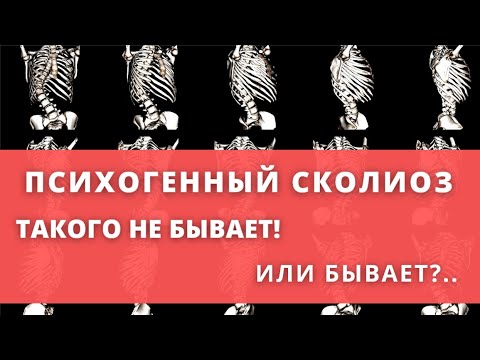 Видео: Психогенный сколиоз. Такого не бывает! Или бывает?