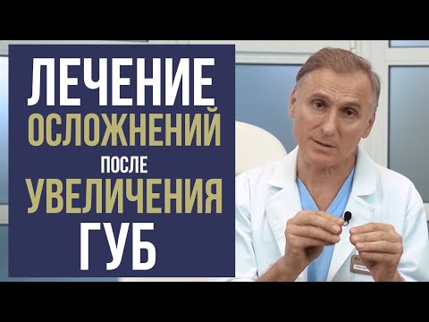 Видео: БИОПОЛИМЕР В ГУБАХ 💉 УДАЛЕНИЕ БИОПОЛИМЕРА 🔪 ГИДРОГЕЛЯ, СИЛИКОНА ИЗ ГУБ