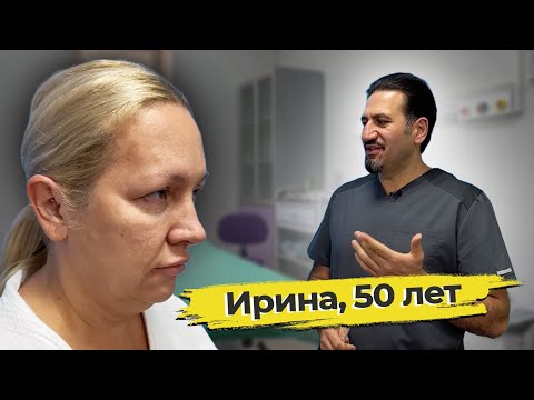 Видео: Омоложение лица: Ирина, 50 лет