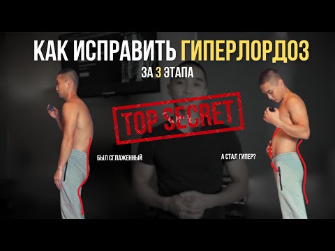 Видео: Как исправить ГИПЕРЛОРДОЗ за 30 дней | Полная инструкция до результата!