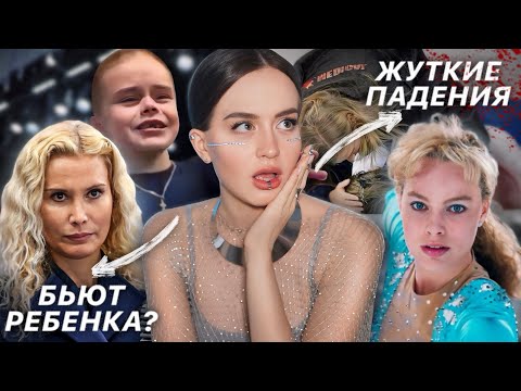 Видео: СТРАШНАЯ жизнь фигуристок | КАК фигурное катание может превратить жизнь В КОШМАР | Травмы, трагедии