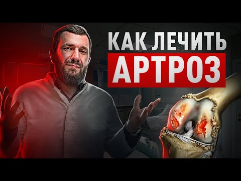Видео: АРТРОЗ - что это и как ЛЕЧИТЬ ?