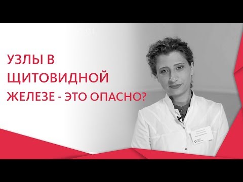 Видео: Узлы в щитовидной железе. 😲 Симптомы и причины появления узлов в щитовидной железе. 12+