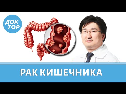 Видео: Хирург-онколог Бадма Башанкаев о раке кишечника