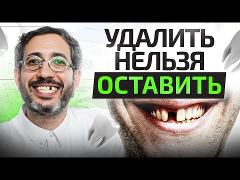Видео: Больной зуб – УДАЛИТЬ или ОСТАВИТЬ? Как стоматолог принимает решение