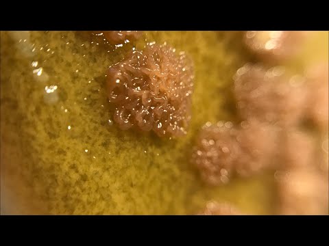 Видео: Редкий Pseudomonas / Citrobacter / Stenotrophomonas. Посев в баклаборатории. Особенности диагностики