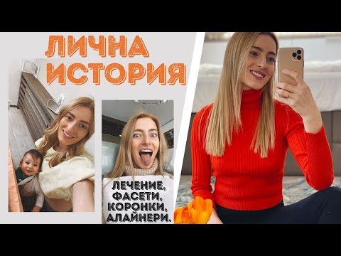 Видео: НОВА УСМИВКА? ПОЛЕЗНИ съвети за лечение, алайнери и фасети