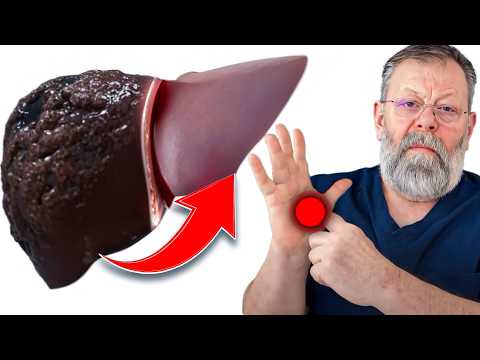 Видео: ПОКАЖУ КАК БЫСТРО ЧИСТИТЬ ПЕЧЕНЬ ЗА 1 ДЕНЬ