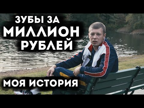 Видео: Зубы за МИЛЛИОН рублей. Моя история. Бюгельный протез против имплантов