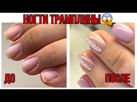 Видео: НОГТИ ТРАМПЛИНЫ😐Преображение вверх растущих ногтей😍Простой маникюр